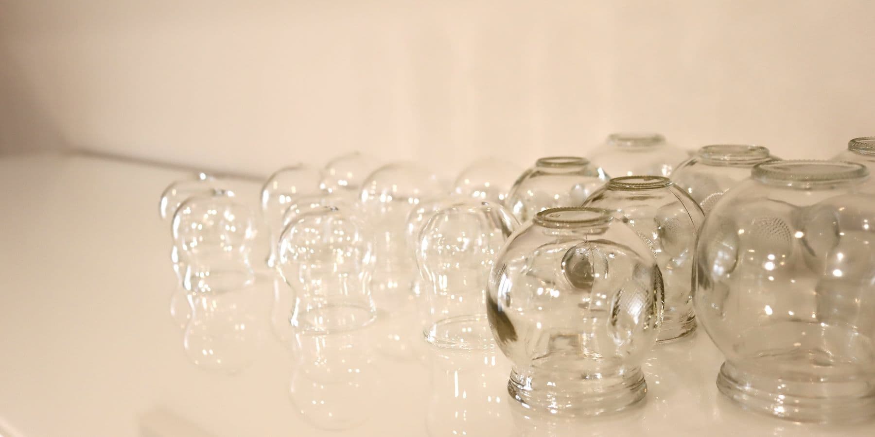 naturheilkunde-praxis-maureen-liebschner-zuerich-schroepfen-ausleitverfahren