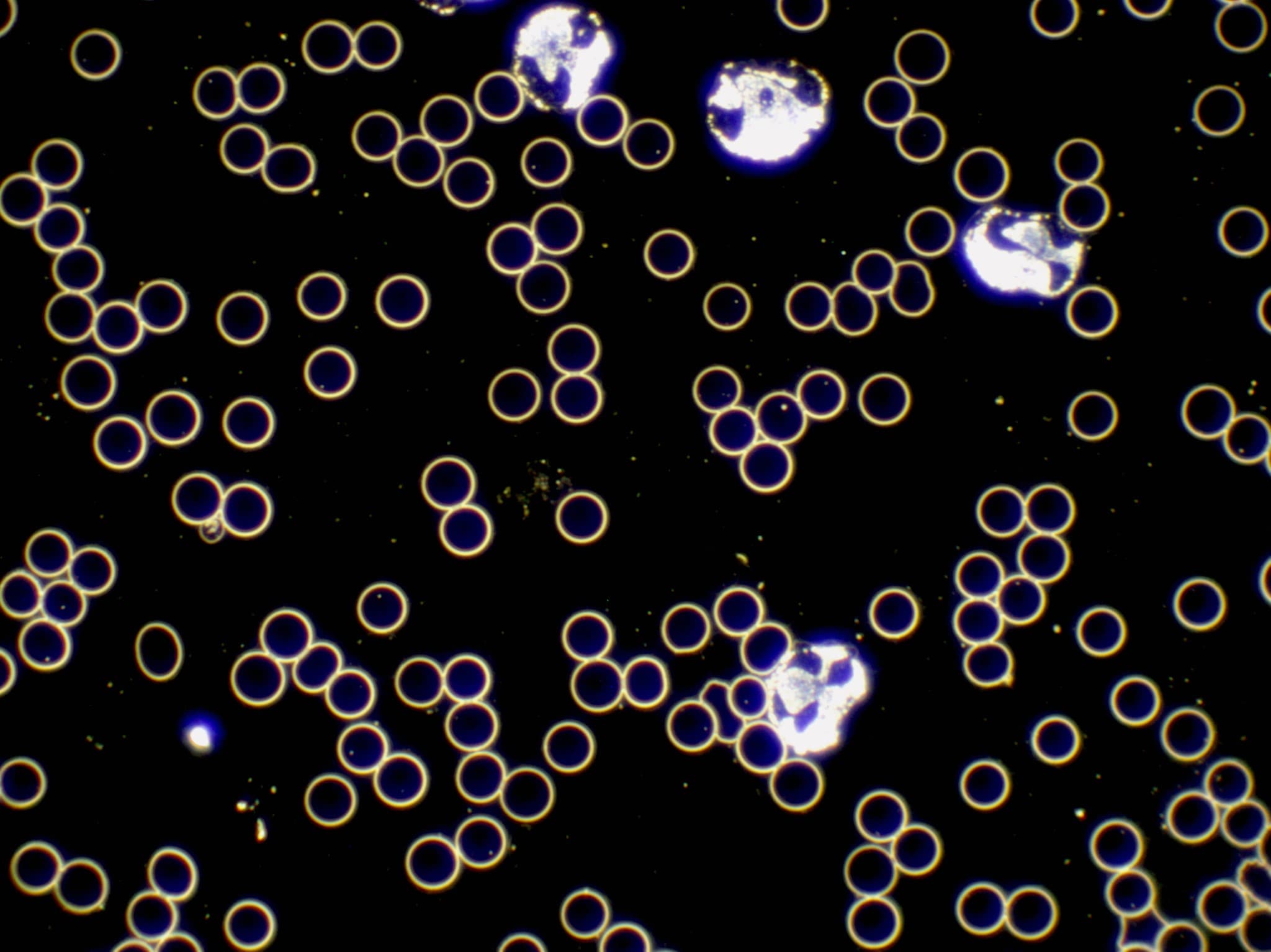 Dunkelfeldmikroskopie